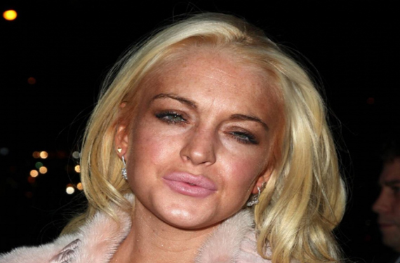 corazon Lindsay Lohan, desfigurada por el alcohol quiere operarse
